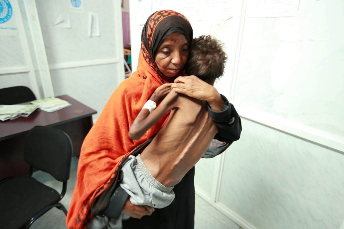 اليمن أكثر الدول المتضررة من المجاعة
