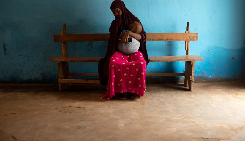 تحمل رحمة طفلها زكريا ذا العام الواحد ويعاني من سوء التغذية الشديد في المركز الطبي بقرية بيدوه بانتظار العلاج