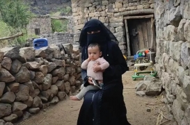 منى مع طفلها جرّاح في منزلهما بمحافظة المحويت شمال غرب اليمن.