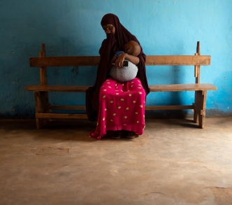 تحمل رحمة طفلها زكريا ذا العام الواحد ويعاني من سوء التغذية الشديد في المركز الطبي بقرية بيدوه بانتظار العلاج