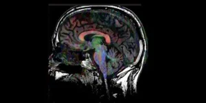 هل دماغنا ضعيف بسبب الإنترنت؟