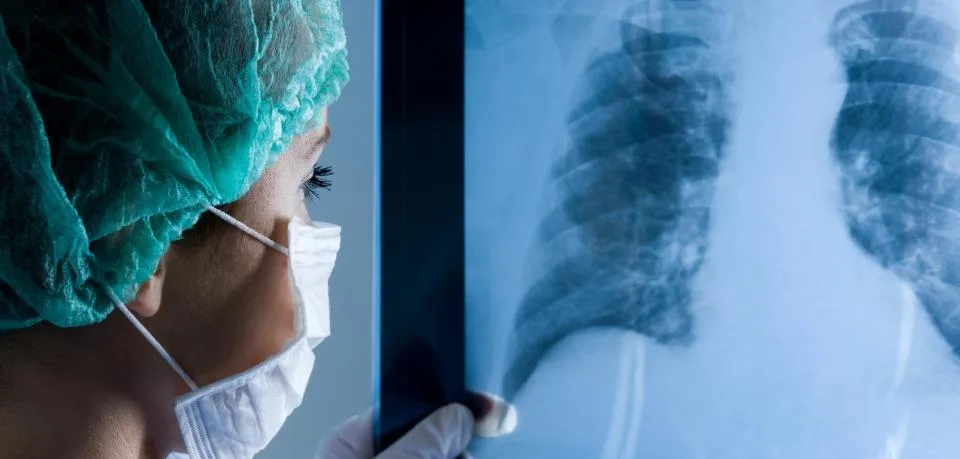 female-doctor-wearing-a-mask-looking-at-x-ray