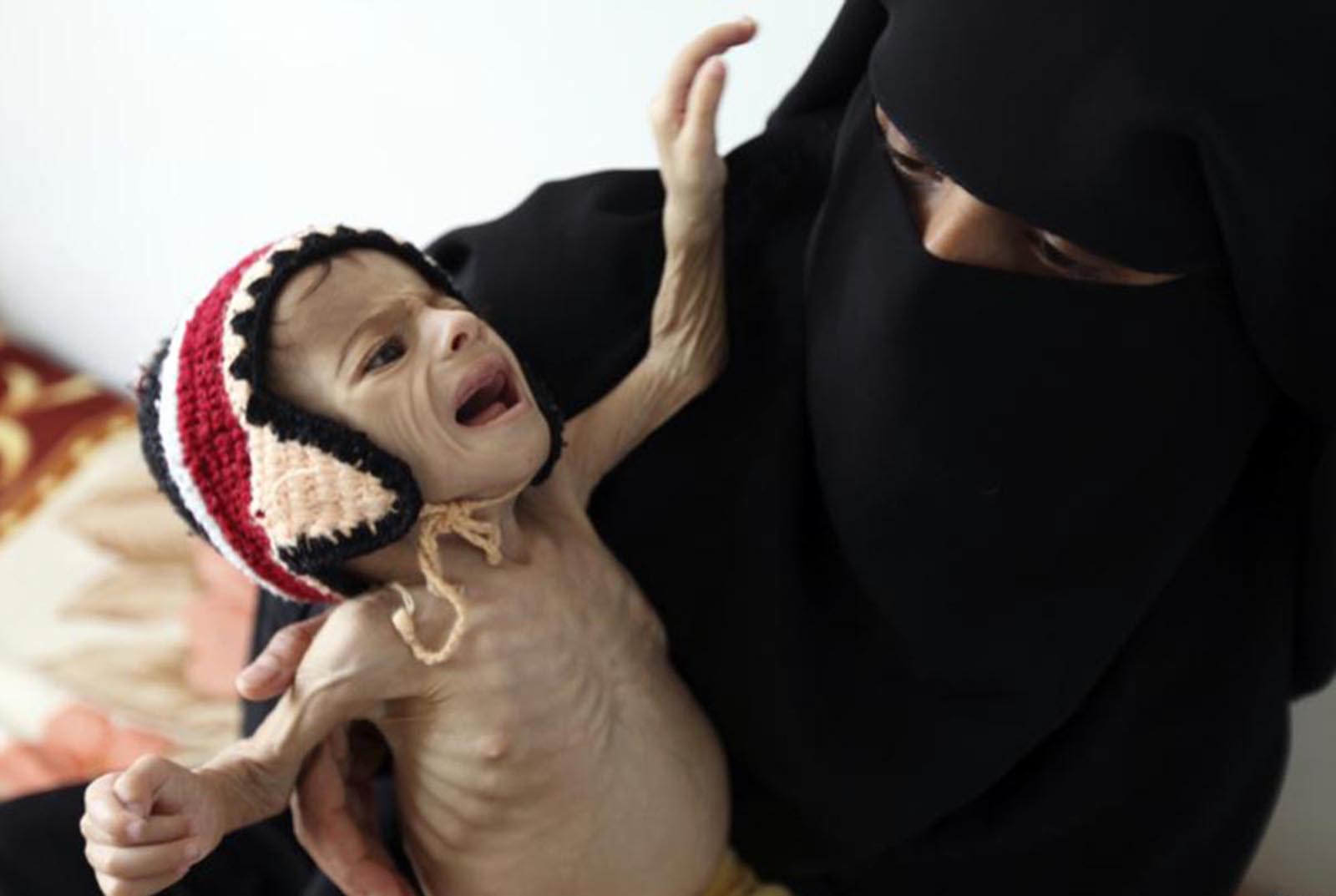 صورة