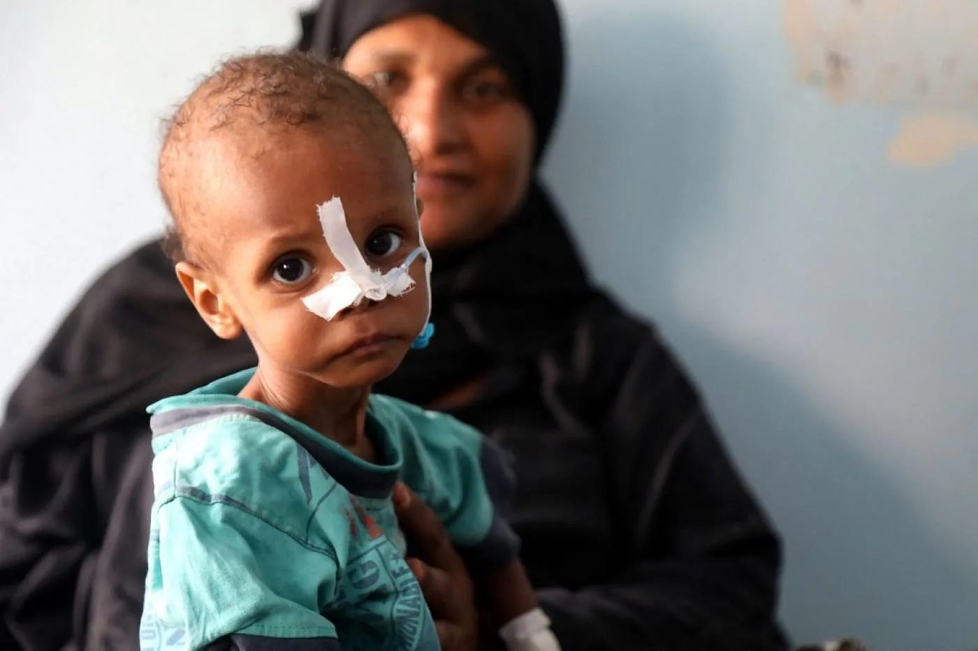 أم تحمل طفلها المصاب بسوء التغذية في منشأة في تعز في اليمن، في 3 تموز/ يوليو 2021.
