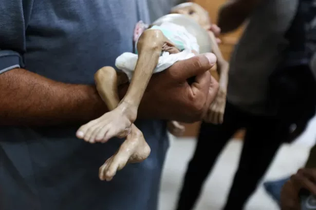 متلازمة غيلان باريه في غزة/ رويترز