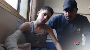 “هل ستعود لي قدمي؟”.. قصة طفل تلخص مأساة البتر في غزة