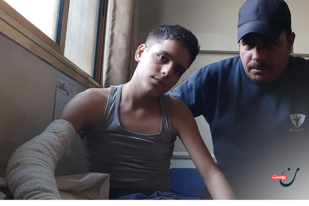 “هل ستعود لي قدمي؟”.. قصة طفل تلخص مأساة البتر في غزة