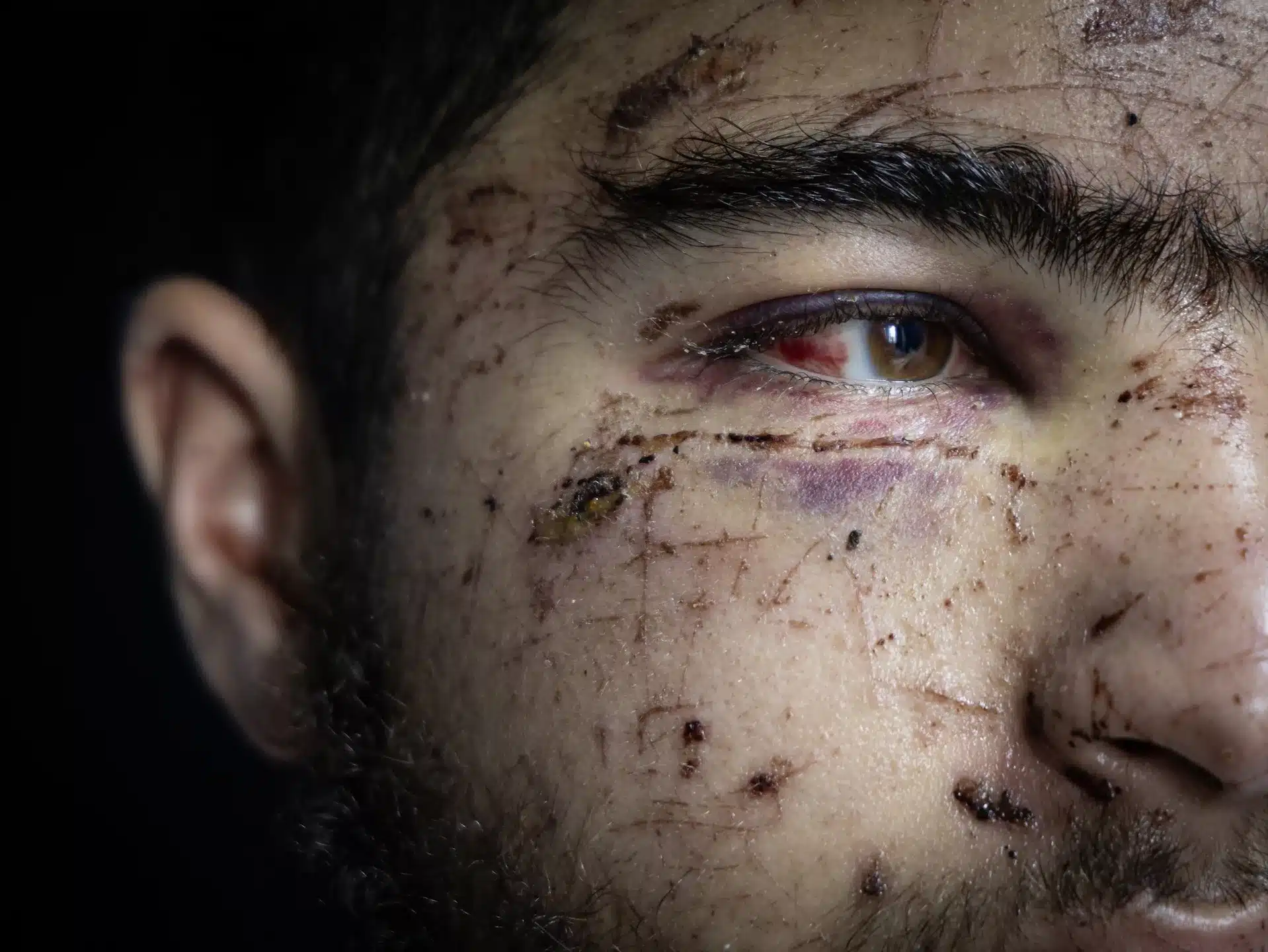 عملية اختطاف استيطانية: شهادة فتى فلسطيني نجا من الموت 25 نون بوست