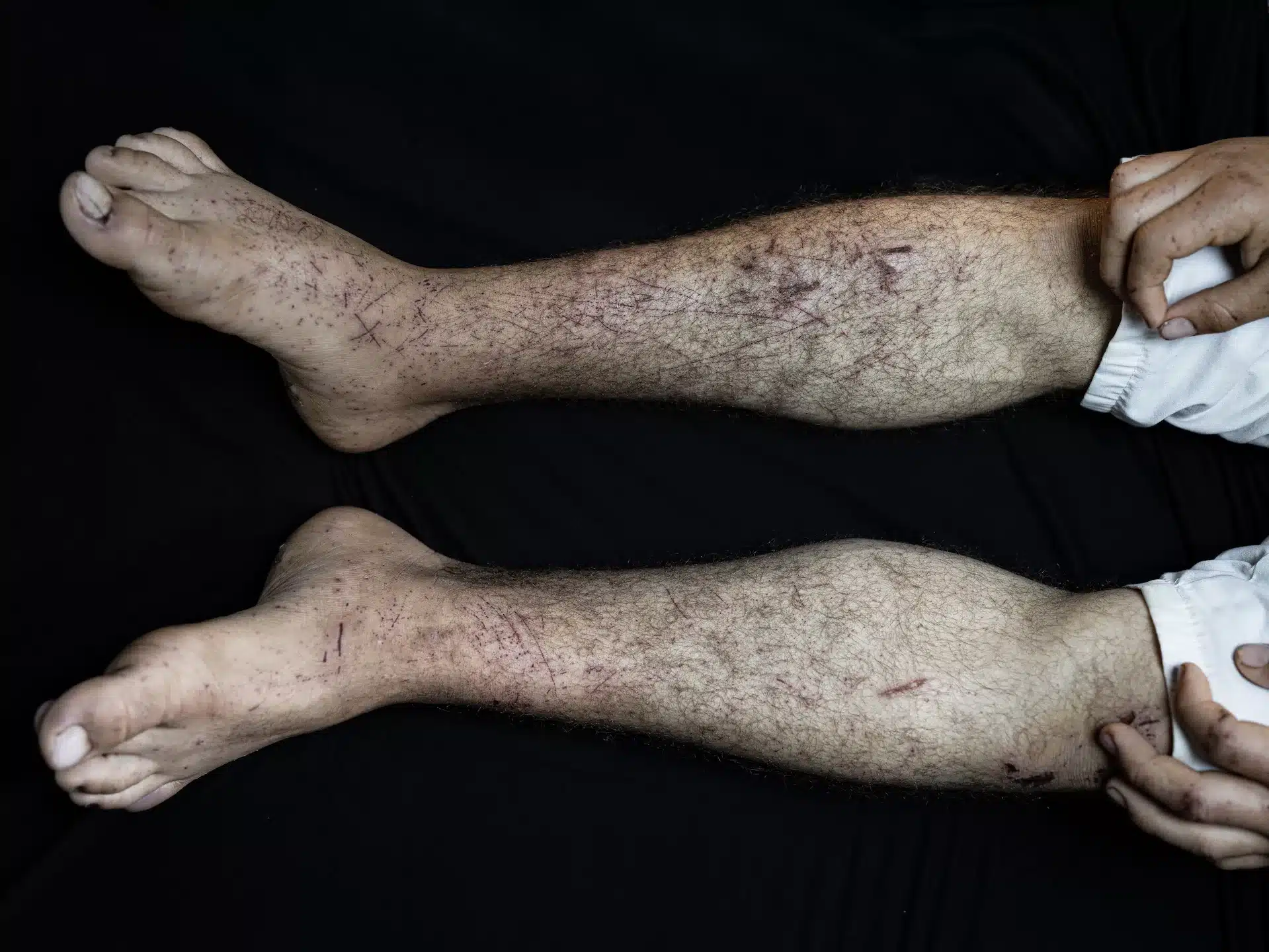 عملية اختطاف استيطانية: شهادة فتى فلسطيني نجا من الموت 23 نون بوست