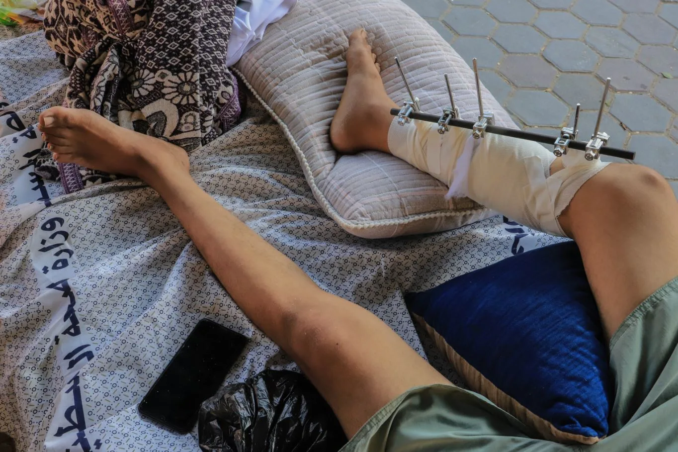 "أشعر بماسّ كهربائي ينخر عظامي".. واقع صحي قاسٍ يعيشه مصابو الإبادة الإسرائيلية 22 نون بوست