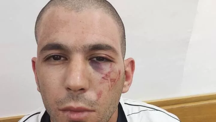 The Colonized Face and Its Resistance: Why Does Israel Engrave Its Symbols on Palestinian Bodies? 37 نون بوست