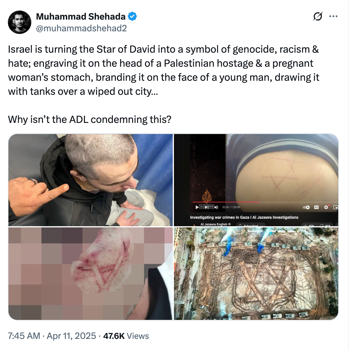 The Colonized Face and Its Resistance: Why Does Israel Engrave Its Symbols on Palestinian Bodies? 39 نون بوست