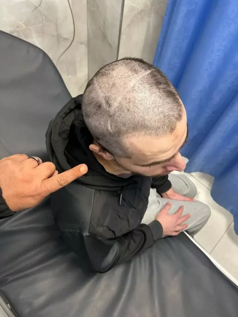 The Colonized Face and Its Resistance: Why Does Israel Engrave Its Symbols on Palestinian Bodies?