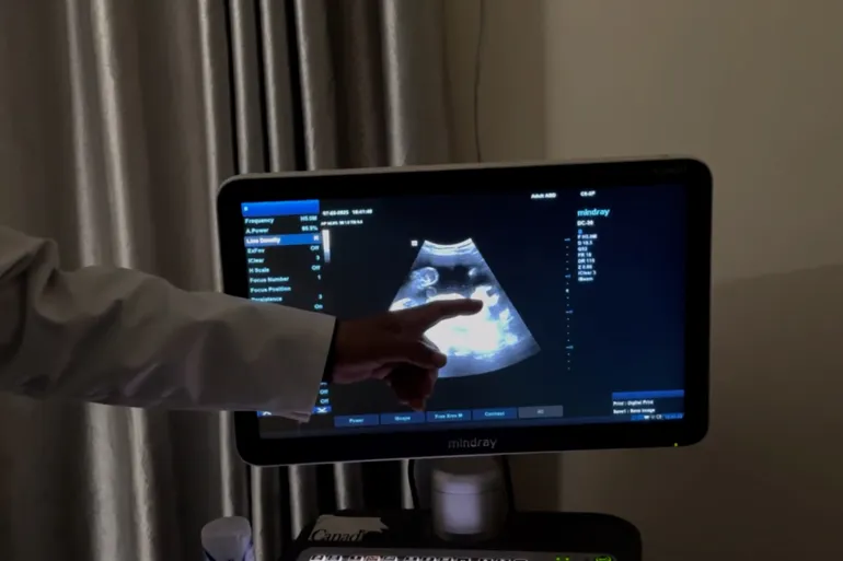 Malformed Fetuses in Gaza: The Continuity of Colonisation 39 نون بوست