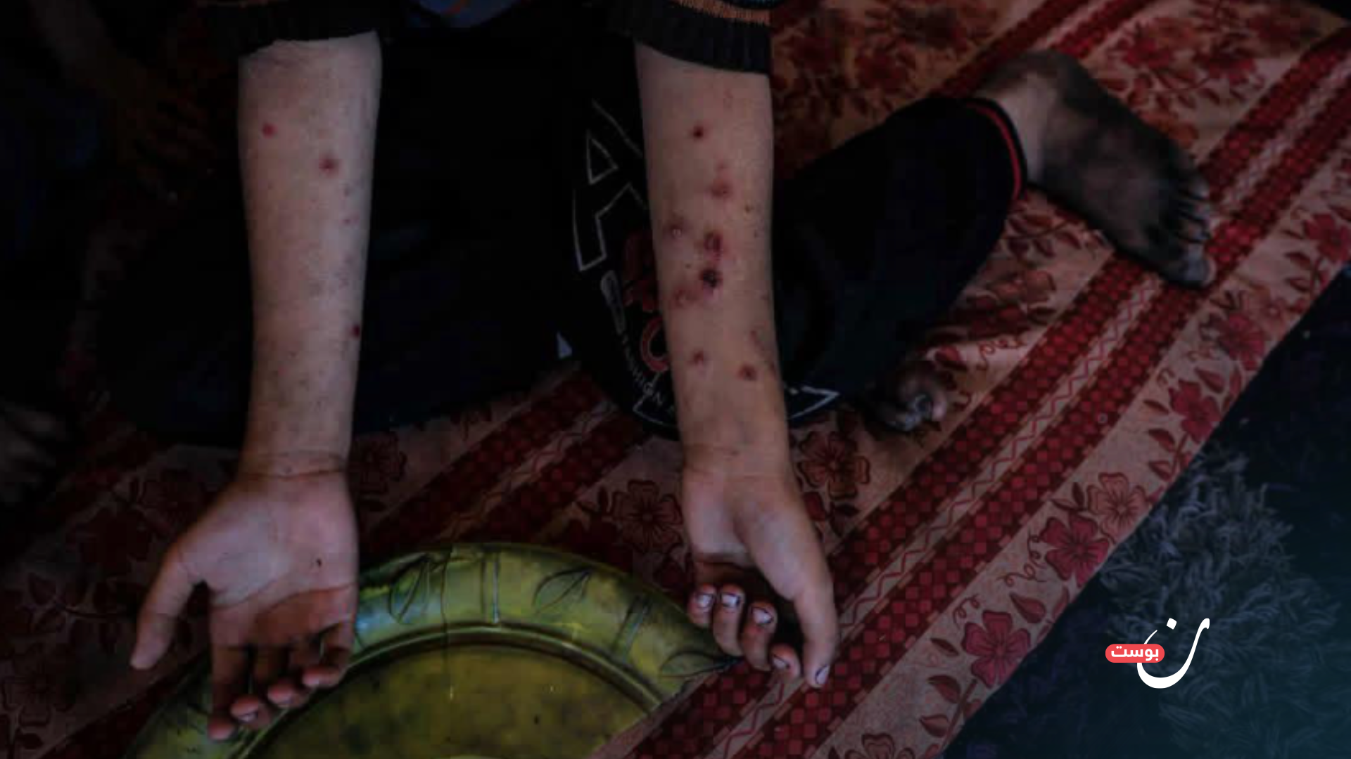 “We’re Not Facing One War”: Gazans Struggle with Thirst and Contamination 39 نون بوست